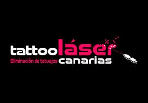 Tattoo Láser Canarias