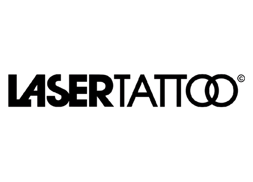 laser-tattoo