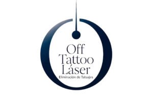 Off Tattoo Láser