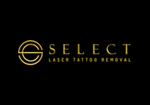 Select Laser Tattoo Málaga